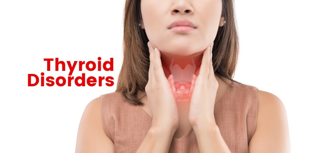Thyroid Disorders